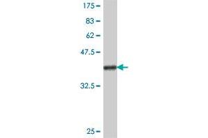 Western Blot detection against Immunogen (38.