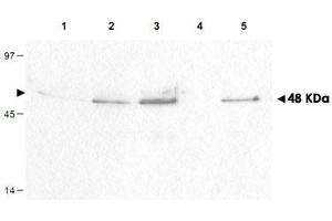 Western blot using CCNB1 (phospho S126) polyclonal antibody  shows detection of a band ~48 kDa corresponding to phosphorylated human CCNB1 (arrowheads) in various whole cell lysates.