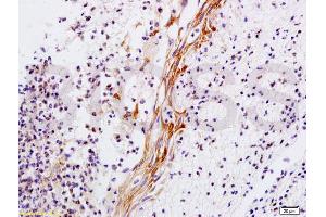 Formalin-fixed and paraffin-embedded rat skin tissue labeled with Anti-Collagen V Polyclonal Antibody, Unconjugated (ABIN669996) 1:200 followed by conjugation to the secondary antibody and DAB staining