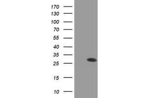Western Blotting (WB) image for anti-Proteasome (Prosome, Macropain) Subunit, beta Type, 9 (Large Multifunctional Peptidase 2) (PSMB9) (AA 21-219) antibody (ABIN1491190) (PSMB9 anticorps  (AA 21-219))