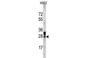 Image no. 3 for anti-ES cell expressed Ras (ERAS) (N-Term) antibody (ABIN356980)