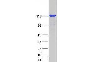 Validation with Western Blot