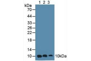 Figure. (S100A6 anticorps  (AA 1-90))