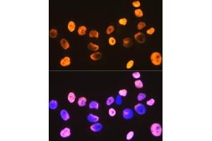 Immunofluorescence analysis of HeLa cells using DDX5 Rabbit mAb (ABIN7266698) at dilution of 1:100 (40x lens). (DDX5 anticorps)