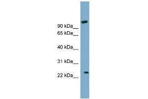 WB Suggested Anti-ARL8B Antibody Titration: 0. (ARL8B anticorps  (Middle Region))