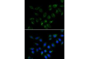 Immunofluorescence analysis of MCF7 cells using BMP15 antibody (ABIN6127524, ABIN6137593, ABIN6137594 and ABIN6223163). (BMP15 anticorps  (AA 143-392))