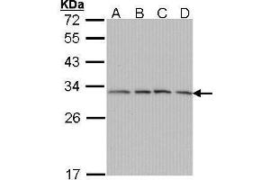WB Image Sample (30 ug of whole cell lysate) A: A431 , B: H1299 C: Hela D: Hep G2 , 12% SDS PAGE antibody diluted at 1:1000 (PSMA7 anticorps  (Center))