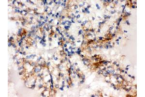 Immunohistochemistry (Paraffin-embedded Sections) (IHC (p)) image for anti-Sulfotransferase Family, Cytosolic, 2A, Dehydroepiandrosterone (DHEA)-Preferring, Member 1 (SULT2A1) (AA 253-285), (C-Term) antibody (ABIN3043941) (SULT2A1 anticorps  (C-Term))