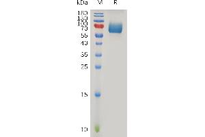 Human IF Protein, hFc Tag on SDS-PAGE under reducing condition.