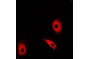 Immunofluorescent analysis of TIM staining in Hela cells. (TPI1 anticorps)