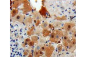 Used in DAB staining on fromalin fixed paraffin-embedded Liver tissue (PSMD10 anticorps  (AA 1-226))