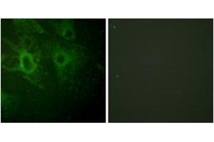 Immunofluorescence analysis of HeLa cells, using HCK (Phospho-Tyr410) Antibody. (HCK anticorps  (pTyr410))