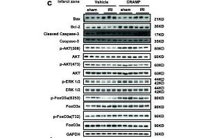 CRAMP reduces cardiac I/R injury in vivo.