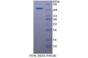 SDS-PAGE (SDS) image for Interferon alpha (IFNA) (AA 47-191) protein (His tag,GST tag) (ABIN2123047)