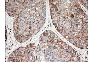 Immunohistochemistry (IHC) image for anti-Tubulin beta 4a (TUBB4A) antibody (ABIN1501580)