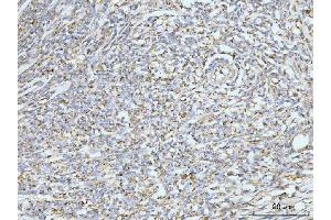 IHC analysis of GRPEL1 using anti-GRPEL1 antibody (ABIN7602643). (GRPEL1 anticorps  (AA 90-217))