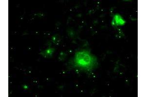 Anti-PRL mouse monoclonal antibody (ABIN2453519) immunofluorescent staining of COS7 cells transiently transfected by pCMV6-ENTRY PRL (RC205627). (Prolactin anticorps)