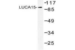 Western blot (WB) analysis of LUCA15 antibody in extracts from HHUVEC cells.