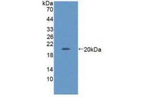 Detection of Recombinant GABPa, Human using Polyclonal Antibody to GA Binding Protein Transcription Factor Alpha (GABPa)