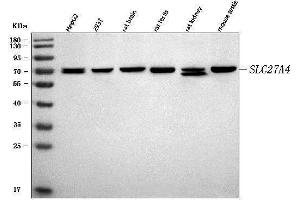 Western blot analysis of FATP4/SLC27A4 using anti-FATP4/SLC27A4 antibody (ABIN7600117).