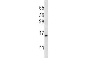 BAFF antibody western blot analysis in K562 lysate. (TNFRSF13C anticorps  (AA 1-30))