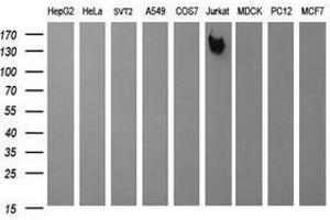 Image no. 2 for anti-Protein tyrosine Phosphatase, Receptor Type, C (PTPRC) antibody (ABIN1497330) (CD45 anticorps)