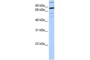 Human 721_B; WB Suggested Anti-ZNF700 Antibody Titration: 0. (ZNF700 anticorps  (C-Term))