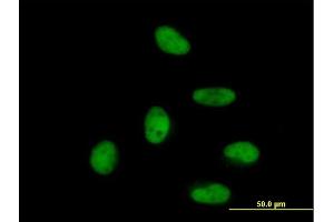Immunofluorescence of purified MaxPab antibody to ZNF496 on HeLa cell.