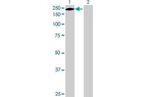 Lane 1: ERCC5 transfected lysate ( 130. (ERCC5 293T Cell Transient Overexpression Lysate(Denatured))