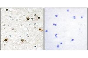 Immunohistochemistry analysis of paraffin-embedded human brain tissue, using NAB2 Antibody. (NAB2 anticorps  (AA 261-310))