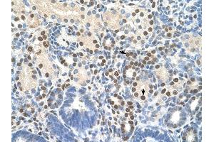 ZNF326 antibody was used for immunohistochemistry at a concentration of 4-8 ug/ml to stain Epithelial cells of renal tubule (arrows) in Human Kidney.