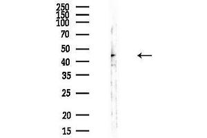 anti-RAD51 Homolog B (Rad51B) antibody