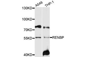 Western blot analysis of extracts of various cell lines, using RENBP antibody (ABIN4904991) at 1:1000 dilution. (RENBP anticorps)