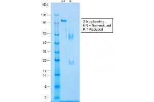 SDS-PAGE Analysis Purified Caldesmon Rabbit Recombinant Monoclonal Antibody (CALD1/1424R).