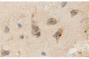 Immunohistochemical staining of formalin-fixed paraffin-embedded human brain showing staining with ANLN polyclonal antibody  at 1:100 dilution.