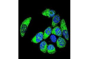 Confocal immunofluorescent analysis of WT1 Antibody (Center ) (ABIN655904 and ABIN2845304) with MCF-7 cell followed by Alexa Fluor® 488-conjugated goat anti-rabbit lgG (green).