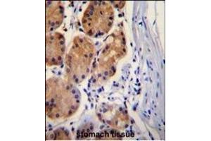 CTNB1 Antibody (C-term) (ABIN655178 and ABIN2844795) immunohistochemistry analysis in formalin fixed and paraffin embedded human stomach tissue followed by peroxidase conjugation of the secondary antibody and DAB staining. (CTNNB1 anticorps  (C-Term))