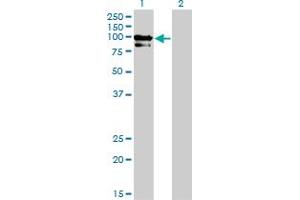Western Blot analysis of OCRL expression in transfected 293T cell line by OCRL monoclonal antibody (M02), clone 4A6.
