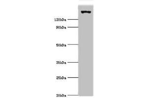 Western blot All lanes: EIF2AK4 antibody at 2 μg/mL + Mouse lung tissue Secondary Goat polyclonal to rabbit IgG at 1/10000 dilution Predicted band size: 187, 184, 70 kDa Observed band size: 187 kDa (GCN2 anticorps  (AA 1-300))