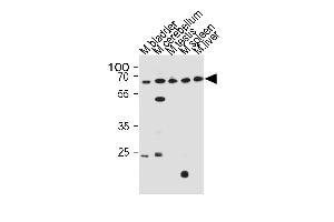 Western blot analysis in mouse bladder,cerebellum,testis,spleen and liver tissue lysates (35ug/lane). (ZNF654 anticorps  (C-Term))