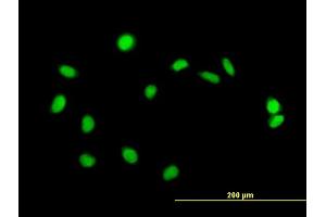 Immunofluorescence of purified MaxPab antibody to ZBED1 on HeLa cell. (ZBED1 anticorps  (AA 1-694))