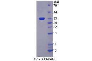 SDS-PAGE analysis of Human EIF3M Protein. (Eukaryotic Translation Initiation Factor 3, Subunit M (EIF3M) Protéine)