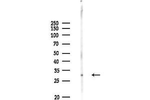 anti-Ovo-Like 2 (OVOL2) (Internal Region) antibody
