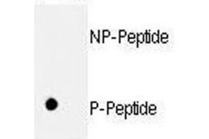 Dot blot analysis of p-Rb1 antibody. (Retinoblastoma Protein (Rb) anticorps  (pSer811))