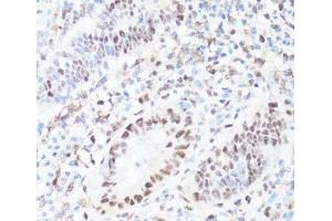 Immunohistochemistry of paraffin-embedded Human appendix using Phospho-MYC(S62) Polyclonal Antibody at dilution of 1:100 (40x lens).
