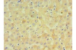 Immunohistochemistry of paraffin-embedded human liver tissue using ABIN7149272 at dilution of 1:100 (CYP4F12 anticorps  (AA 265-524))