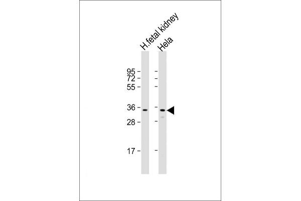 UPP1 anticorps  (AA 205-237)
