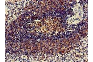 Immunohistochemistry of paraffin-embedded human spleen tissue using ABIN7158646 at dilution of 1:100 (BC055111 anticorps  (AA 1-418))