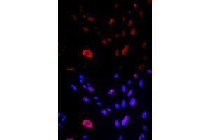 Immunofluorescence (IF) image for anti-HUS1 Checkpoint Homolog (S. Pombe) (HUS1) antibody (ABIN1876595) (HUS1 anticorps)