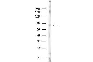 anti-Acyl-CoA Synthetase Short-Chain Family Member 1 (ACSS1) (Lys642) antibody